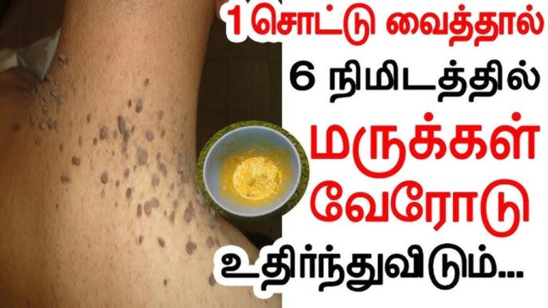 மருக்கள் இலைபோல் கொட்டிப்போக இதை 1 இரவு தடவுங்கள்!! மறுநாள் ஒரு மரு கூட இருக்காது!!