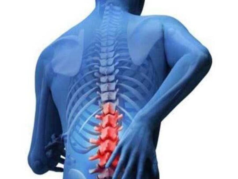 முதுகு தண்டுவட வலி வர காரணங்கள் மற்றும் அதற்கு உரிய சிகிச்சை முறைகள்!!