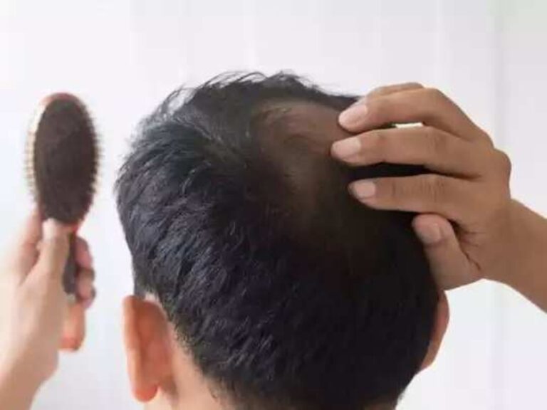 முடி கொட்டிட்டே இருக்கா? தலைமுடி வளர்ச்சிக்கு இனி வீட்டிலேயே சீரம் தயாரிக்கலாம்!!