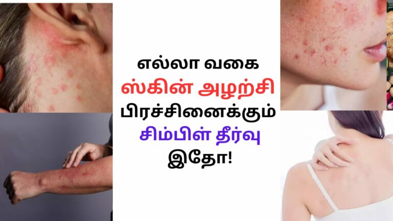 வெற்றிலை இப்படி பயன்படுத்துங்கள்.. தோல் அலர்ஜி பாதிப்பை வாழ்நாளில் பார்க்கமாட்டீங்க!!
