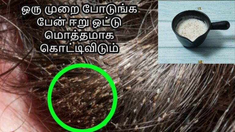 தேங்காய் எண்ணையில் இதை கலந்து தேய்த்தால்.. பேன் பொடுகு அடியோடு நீங்கும்!!