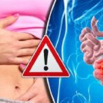 What color is your poo!! Here are the top 5 symptoms of Ulcer!!