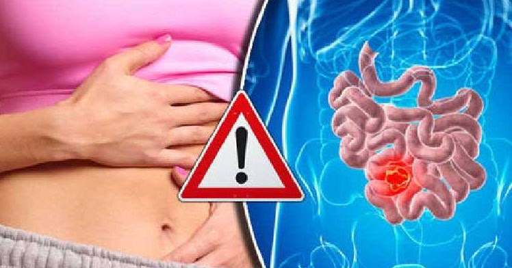 What color is your poo!! Here are the top 5 symptoms of Ulcer!!