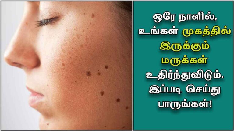 இதை தோல் மருக்கள் மீது தடவினால்.. ஒரே நாளில் மொத்தமும் கொட்டிவிடும்!!