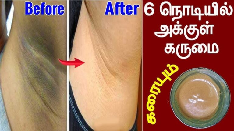 கருப்பு அக்குள் வெள்ளையாக.. தேங்காய் எண்ணையில் இதை கலந்து தடவுங்கள்!!