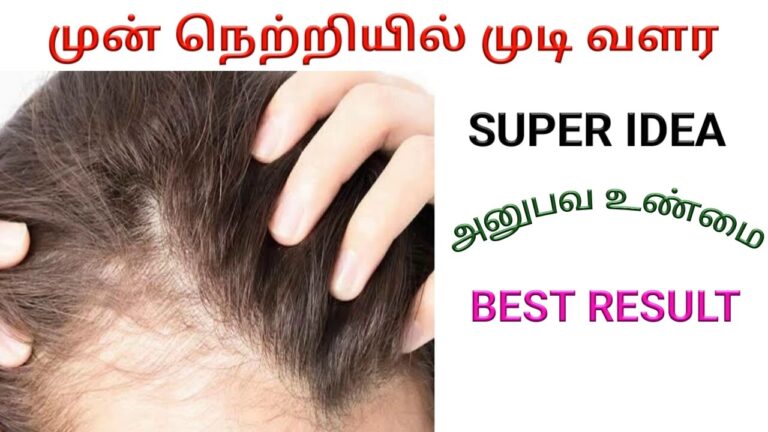 முடி கொட்டலுக்கு நிரந்தர தீர்வு இந்த எண்ணெய்!! முயற்சித்தால் 100% பலன் உண்டு!!