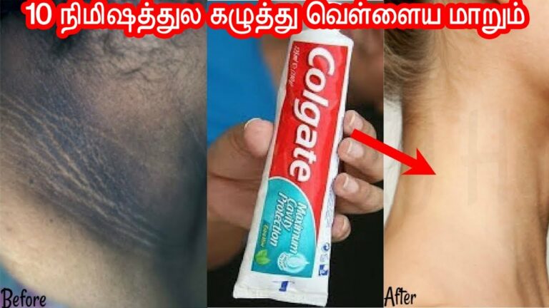 கழுத்து சுற்றி கருப்பா இருக்கா? இதை காணாமல் போகச் செய்யும் சூப்பர் அழகு குறிப்பு!!