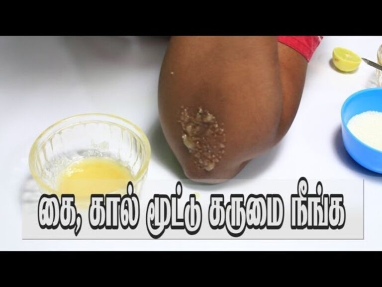 கை முட்டி மற்றும் கால் முட்டி கருப்பா அசிங்கமா இருக்கா? இதை செய்தால் கருப்பு நீங்கும்!!